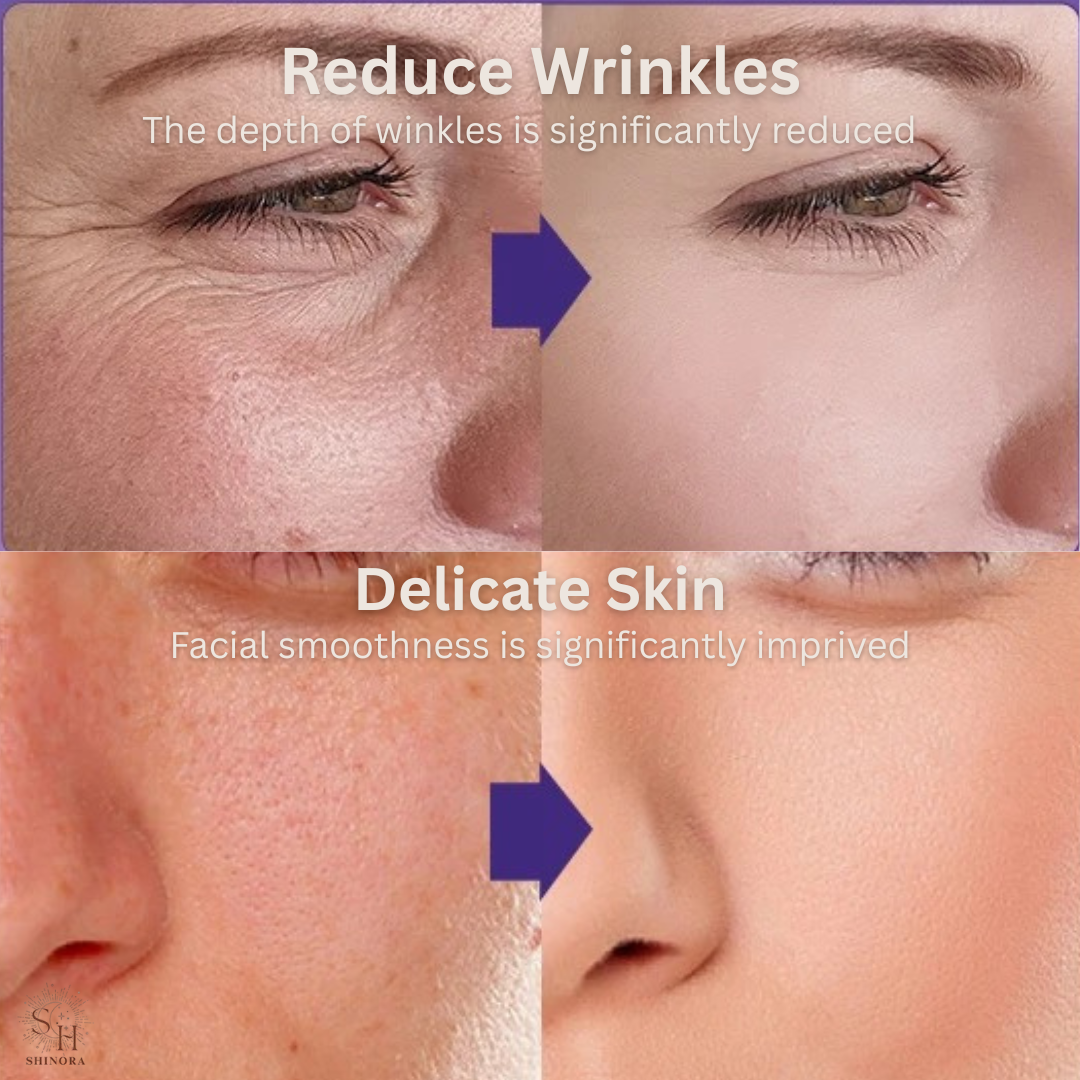 GlowLift 4-in-1 Red Light Therapy + Microcurrent Facial Wand